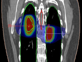 4D kV image