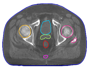 AI enhanced scan
