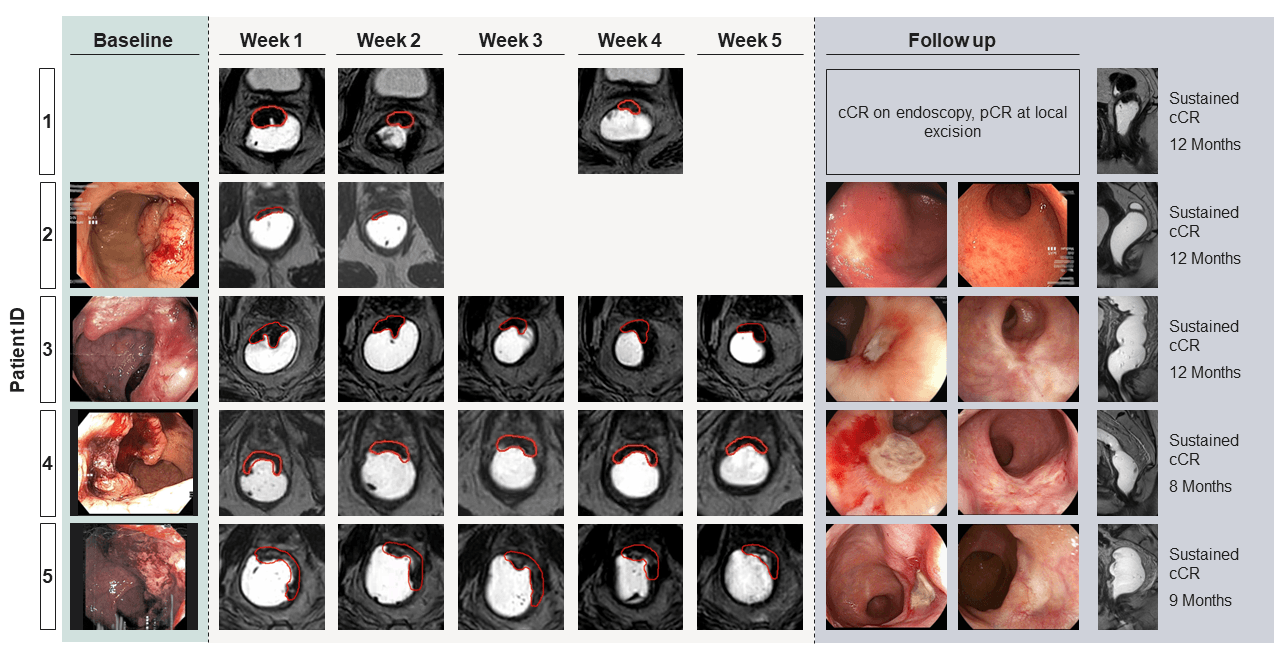 Endoscopic findings for five patients over 5 weeks