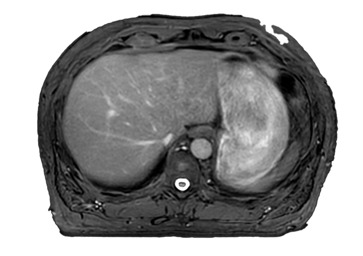 Elekta Imaging